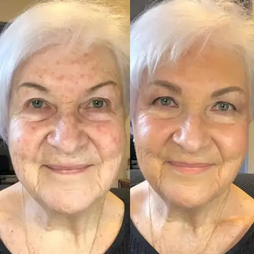 Ageless Skin Kit (+2 Free Gifts)